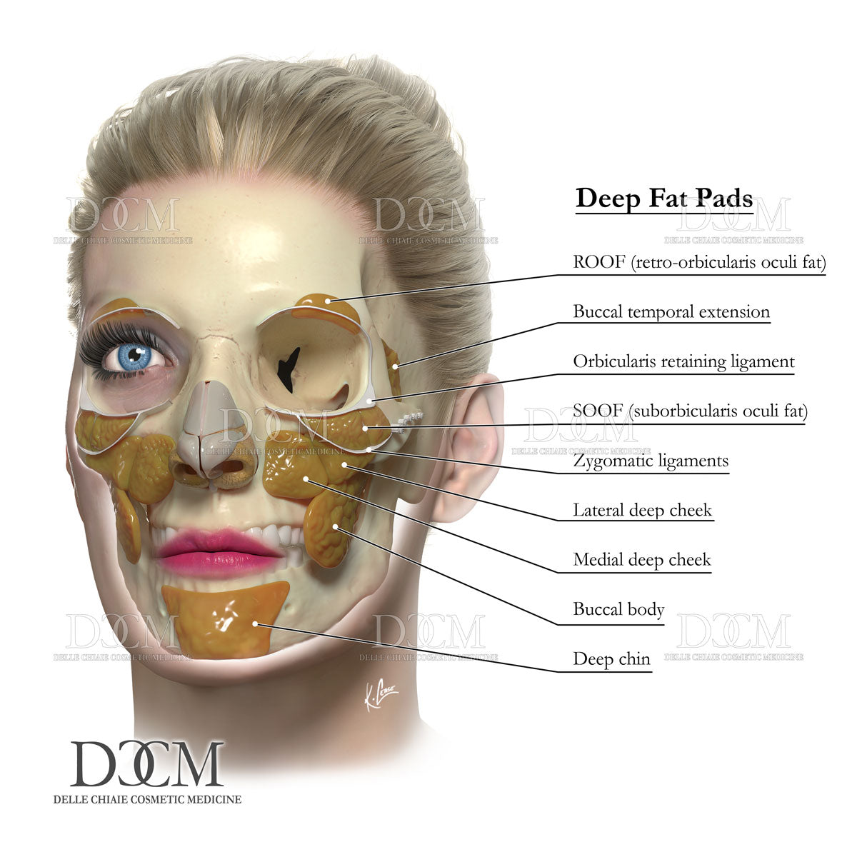 Deep Fat Pads Poster